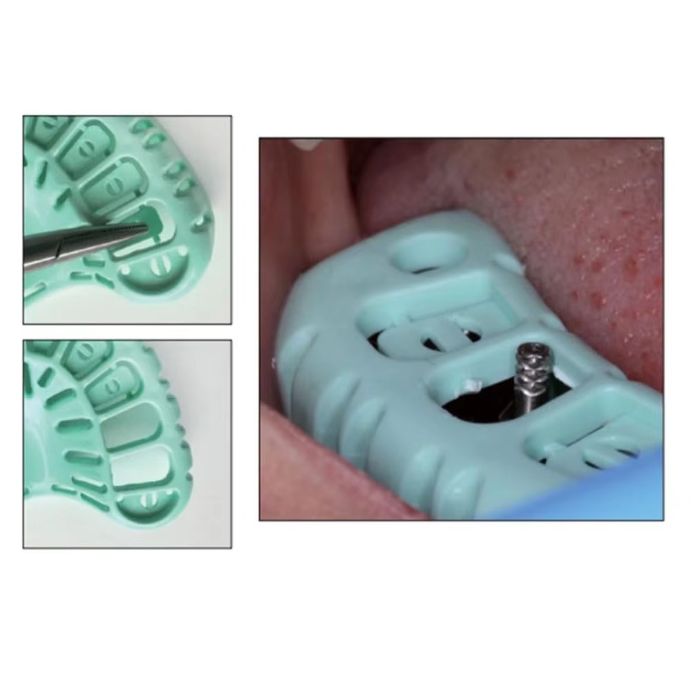 FULAIGE 6個入り使い捨て歯科印象トレー、プラスチック - Dental Impression Material Kit のレビューと価格