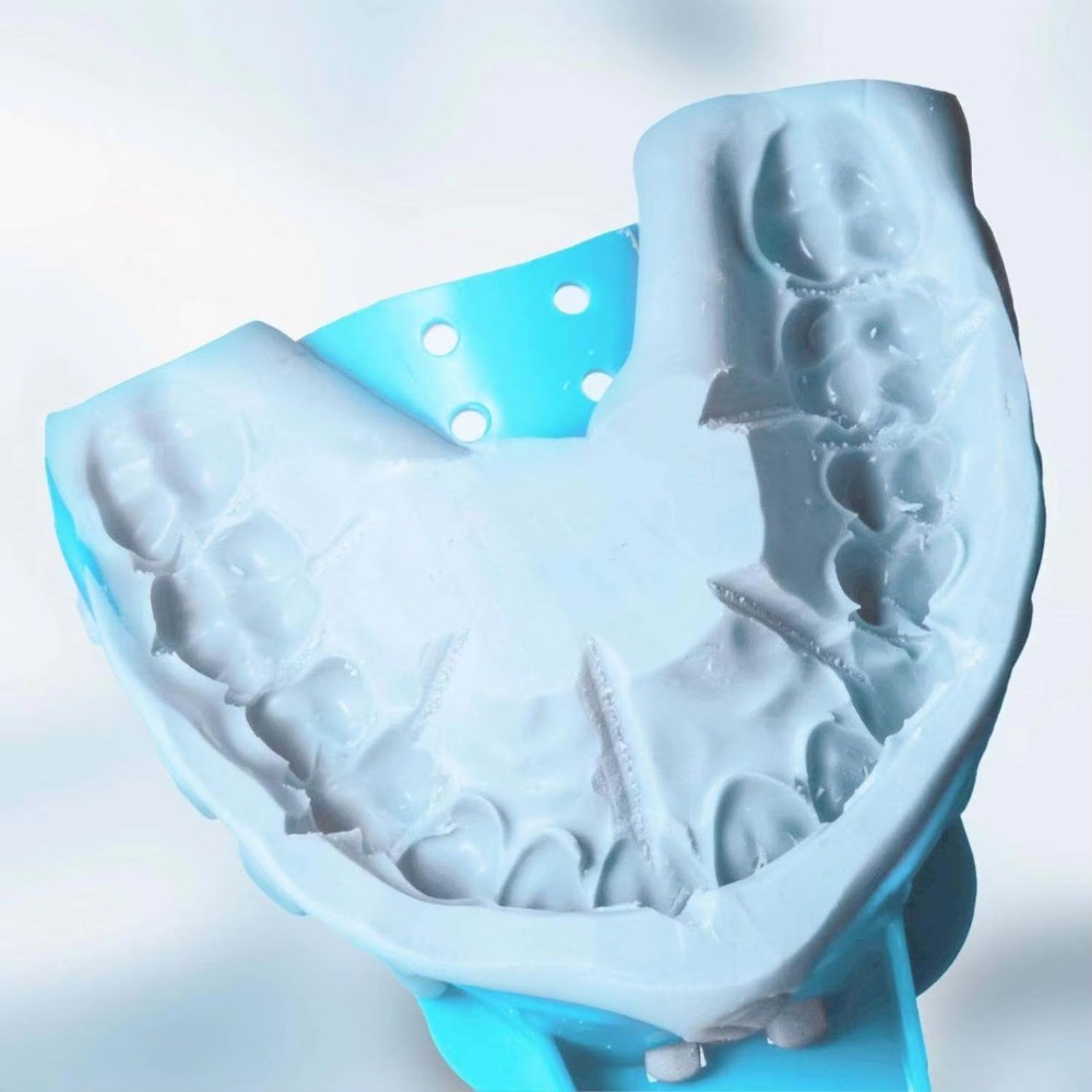 FULAIGE 6個入り使い捨て歯科印象トレー、プラスチック - Dental Impression Material Kit のレビューと価格