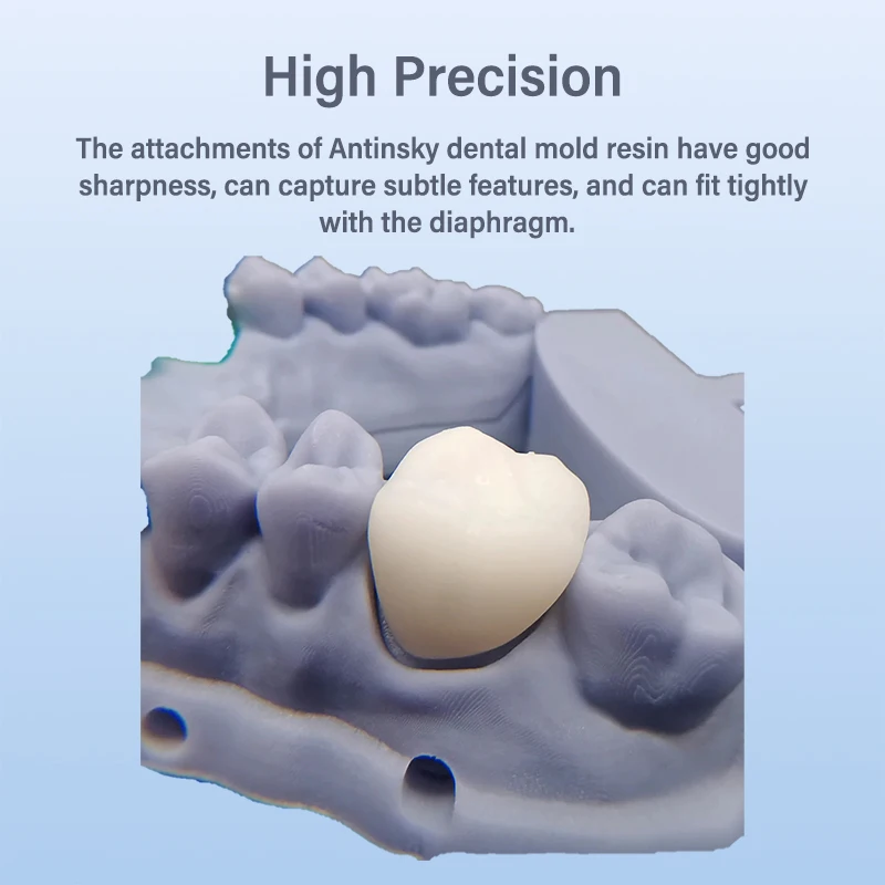 Lodden 3D プリンタ樹脂液体 385/405nm 高 - Dental 3D Printer Resin のレビューと価格