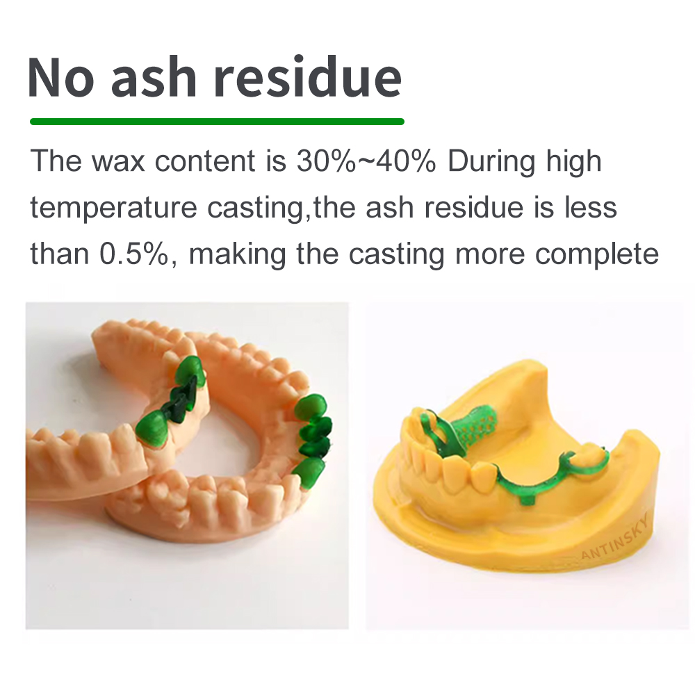 アンティンスキー キャスタブル デンタル スマートレジン 1 - Dental 3D Printer Resin のレビューと価格