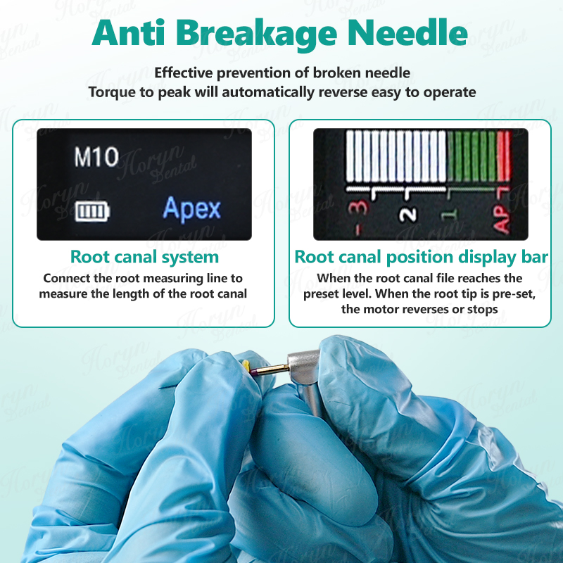 ホリン2in1歯科用ワイヤレスエンドモーター内蔵アペックスロ - Dental Endo Motor Apex Locator のレビューと価格