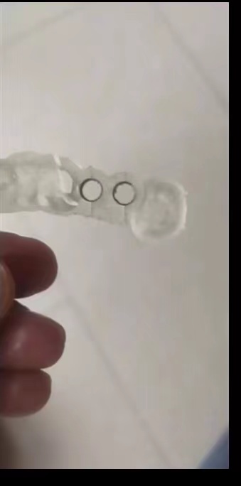 レジンデンタルプリンター,植栽ガイド,高精度の硬さ,uv次元 - Dental 3D Printer Resin のレビューと価格
