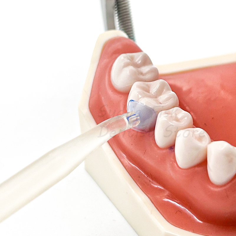 複合歯茎歯科用マトリックス,青色の透明な頸部マトリックス,歯 - Dental Impression Material Kit のレビューと価格